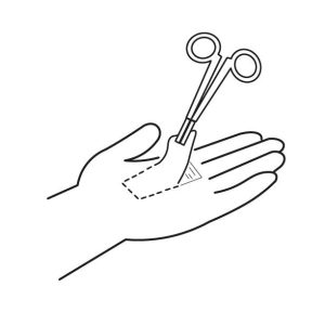 Colgajos locales extremidad superior abordaje anatómico quirúrgico. (observationship)