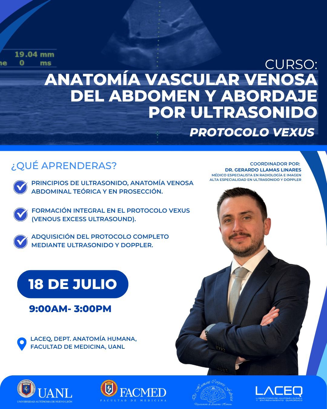 Anatomía vascular venosa del abdomen y abordaje por ultrasonido - Protocolo VEXUS - Imagen 2